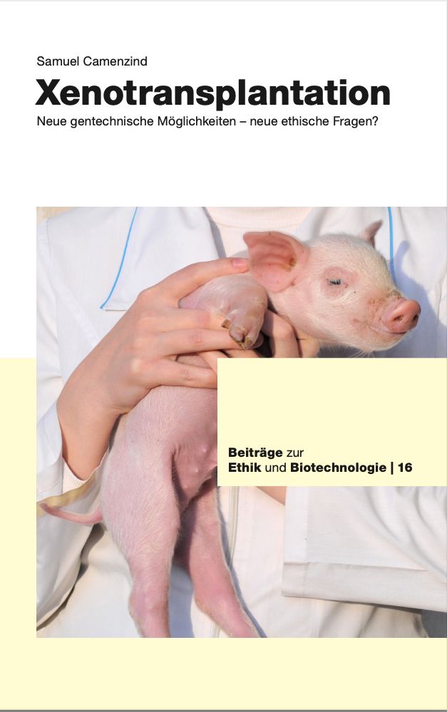 Xenotransplantation. Neue gentechnische Möglichkeiten – neue ethischen Fragen?